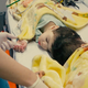 Image for article titled How Virtual Reality Training Helped Surgeons Separate These Conjoined Twins